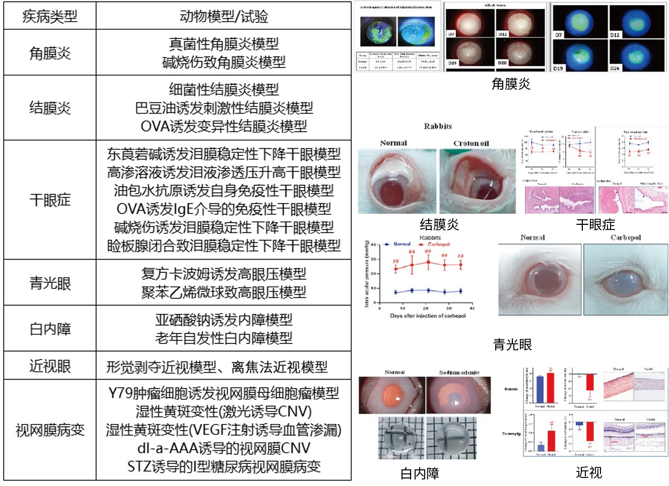 、离焦法近视模型.jpg